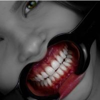 Dentcast cover